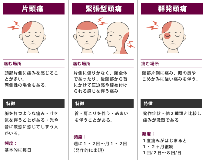 頭痛 冷やす と 治る